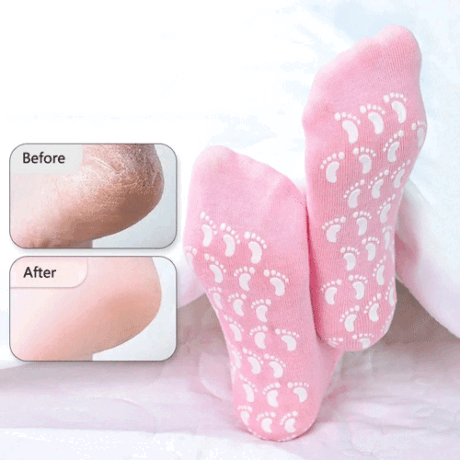 جوراب سیلیکونی ژله ای ترک پا Cracked leg jelly socks#صورتک #SORATAK #WWW.SORATAK.COM