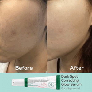 سرم ضد لک اکسیس وای مدل Dark Spot حجم 50 میلی لیتر A Axis Y Dark Spot Correcting Glow Serum